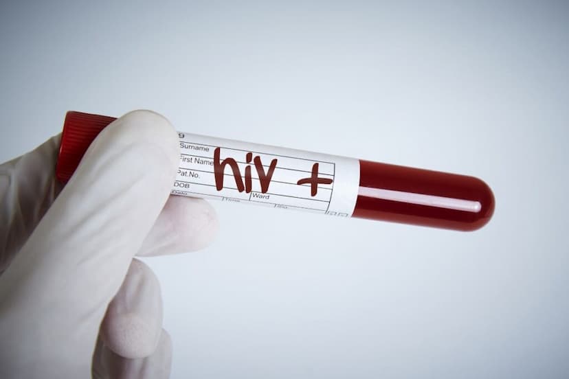 เชื้อ HIV คืออะไร ต่างจากโรคเอดส์อย่างไร ชวนดูสาเหตุและวิธีรักษา2